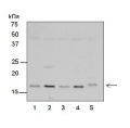 RPS7 | Ribosomal protein S7 (chloroplastic)